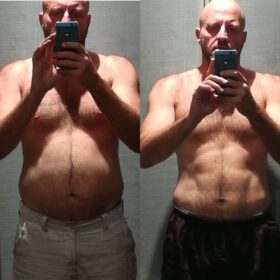 OTG Method - Before and After - Male - 2