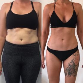 OTG Method - Before and After - Female - 10